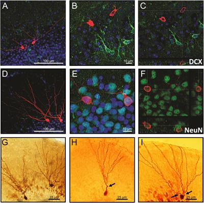 Fragile-X Syndrome Is Associated With NMDA Receptor Hypofunction and Reduced Dendritic Complexity in Mature Dentate Granule Cells